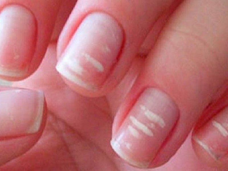 Descubre la Teoría detrás de las Uñas Blancas_teorias Teoria de las uñas blancas_teorias